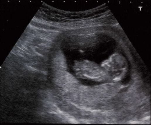 Die Befreiung des Kinderwunsches